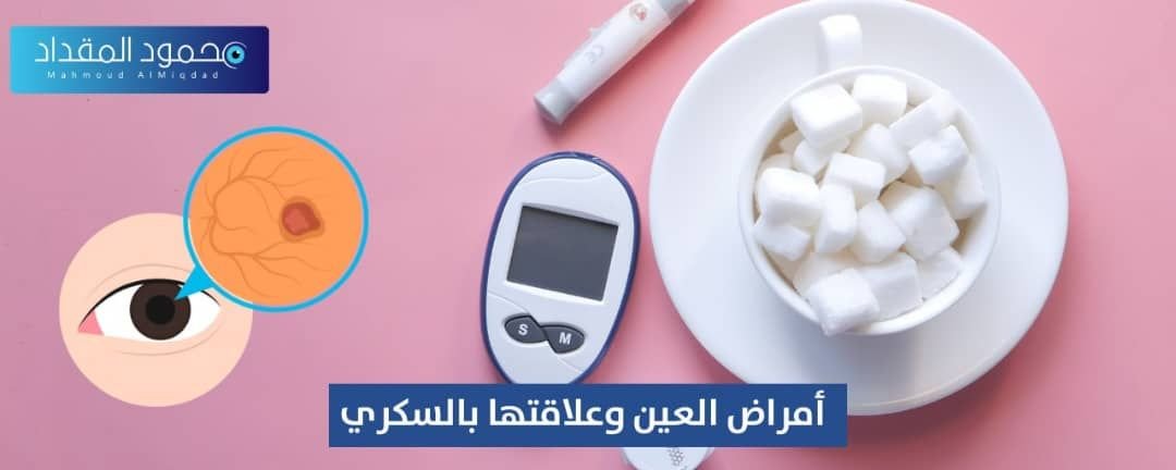 أمراض العين وعلاقتها بالسكري