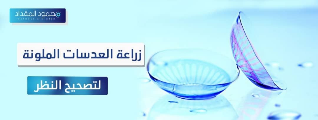 زراعة العدسات الملونة لتصحيح النظر