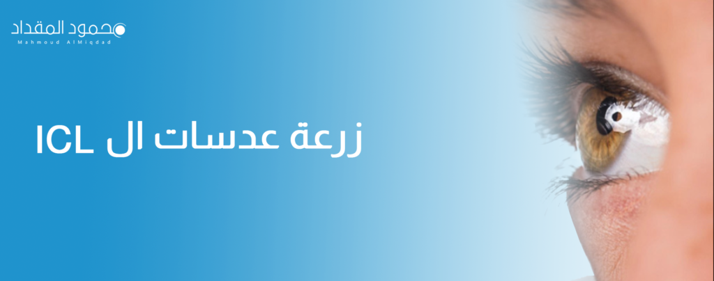 زراعة عدسات ال ICL