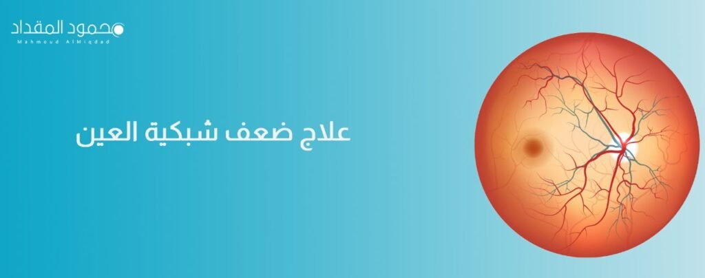 علاج ضعف شبكية العين