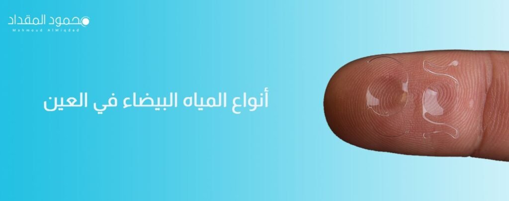 أنواع المياه البيضاء في العين