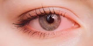 العين الوردية