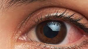 الميكروبيوم العيني