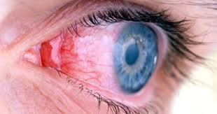 العين مرآة لأمراض الدماغ