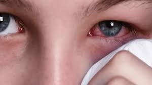 الحساسية البيئية