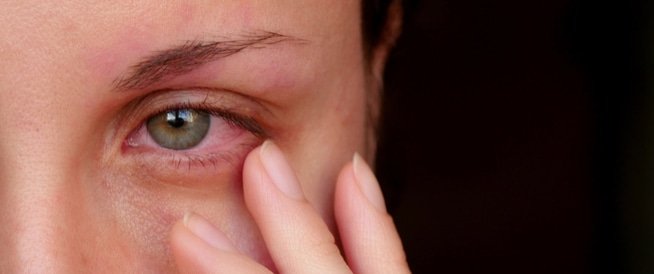 التهاب العين المزمن