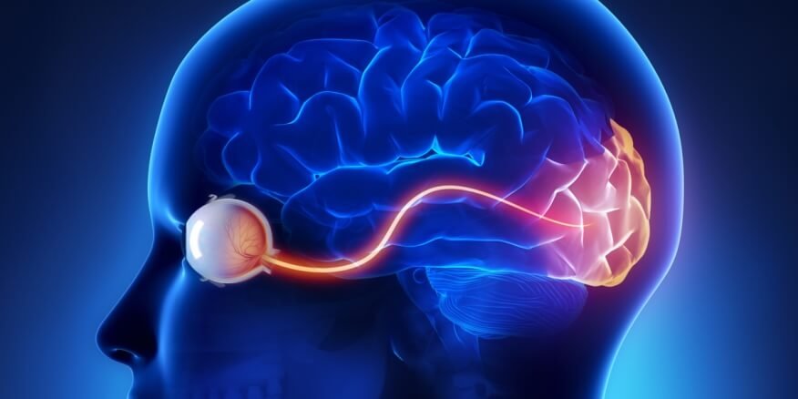 تورم العصب البصري