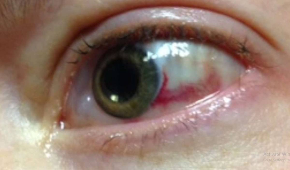 الجسم الزجاجي