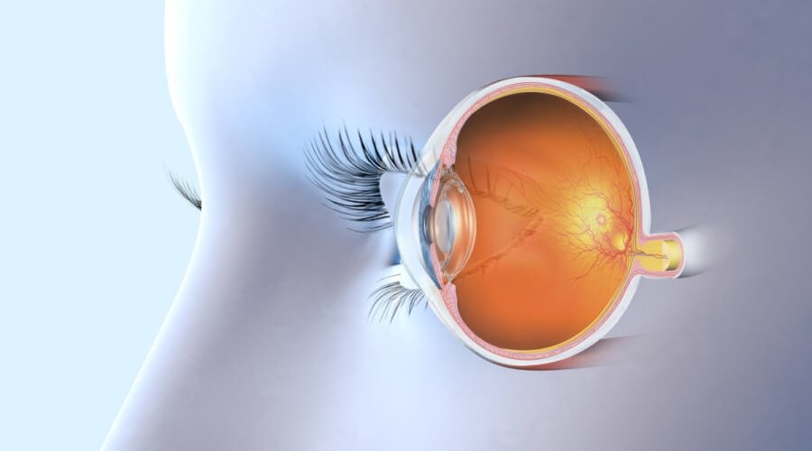 انفصال الجسم الزجاجي