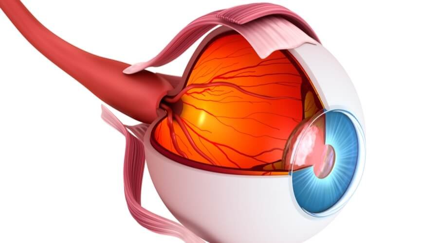 الأورام العصبية