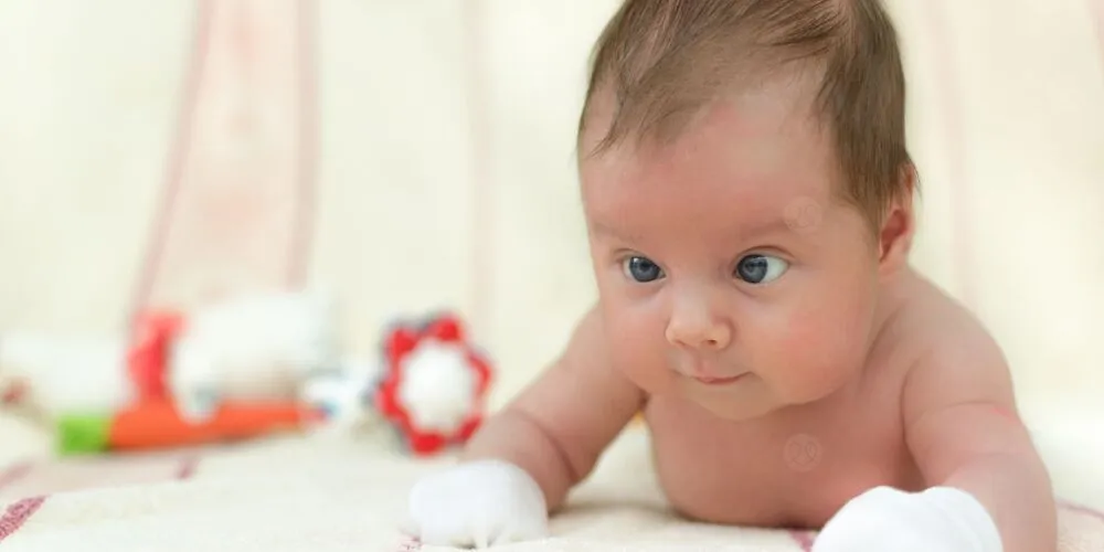 الحول عند الرضع