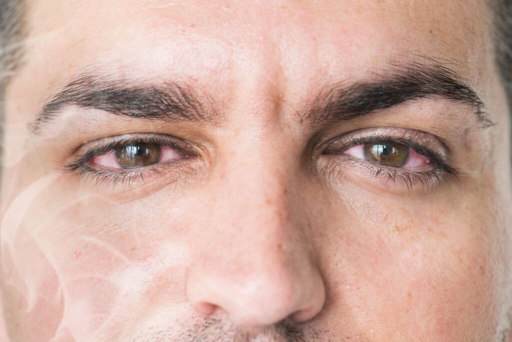 تأثير التدخين على شبكية العين